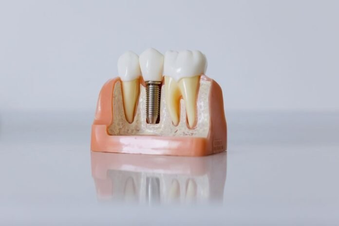 Long-Term Oral Health